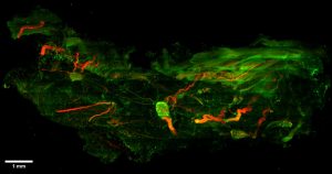 Imaging Of Gps The Brains On The Heart Surface