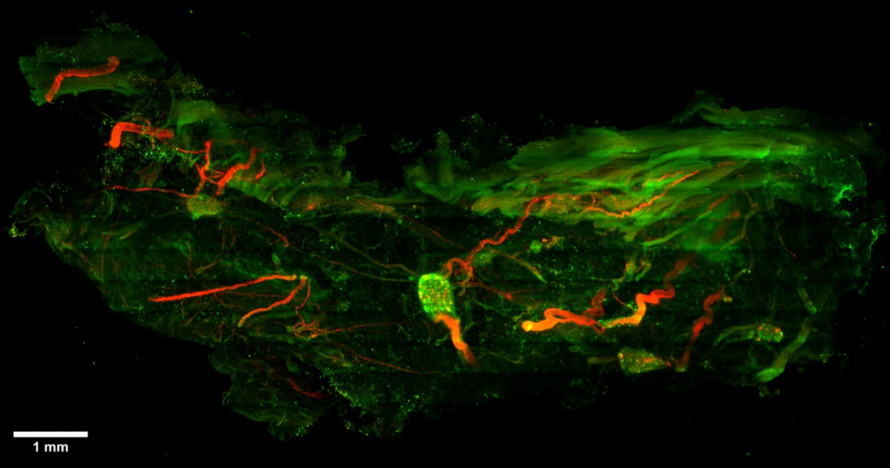 Imaging Of Gps The Brains On The Heart Surface